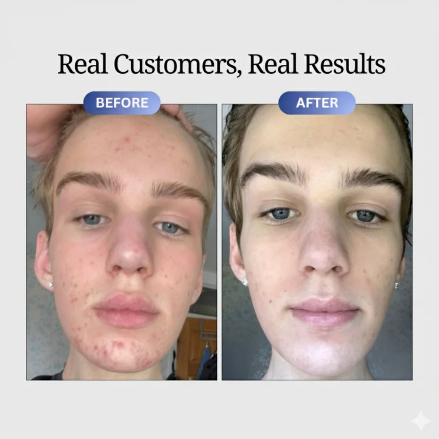 GHK-Cu Peptides Serum